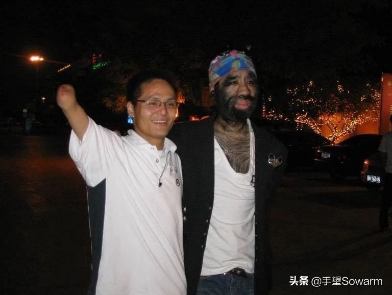 全世界体毛最多的人，是如何在歧视中逆袭为实力派歌手的？