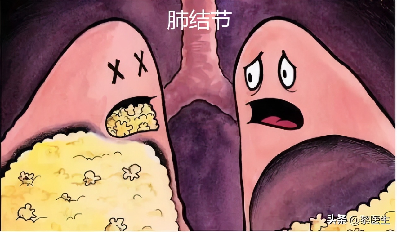 全身有结节囊肿息肉能治愈吗,宫颈囊肿息肉会癌变吗