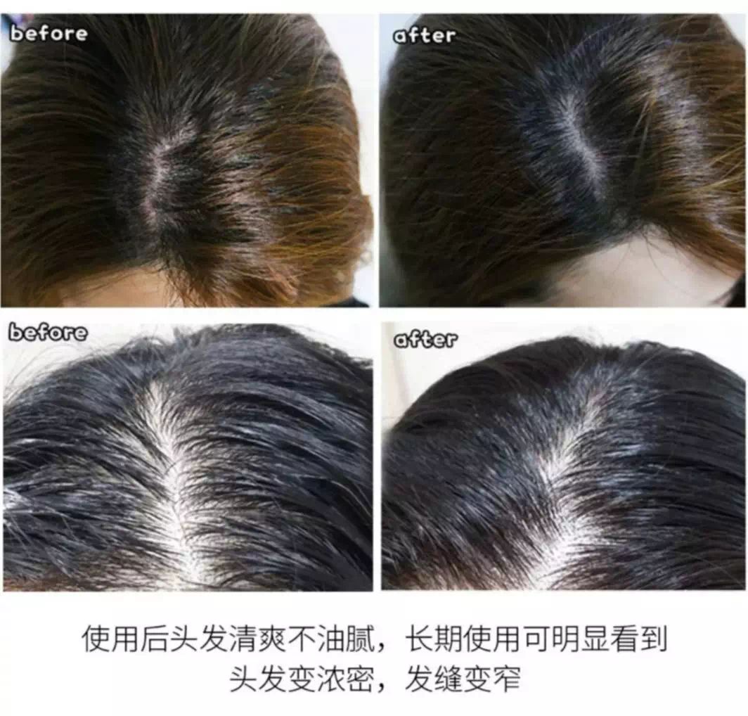 蒙古洗发水,日本洗发水蒙琉怎么样