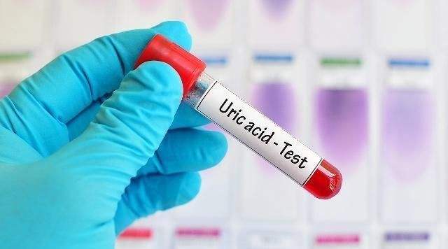 预防痛风吃什么保健品,预防痛风吃什么药没有副作用