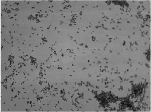 益生菌可以缓解婴儿肠绞痛吗,益生菌能防止婴儿肠绞痛吗