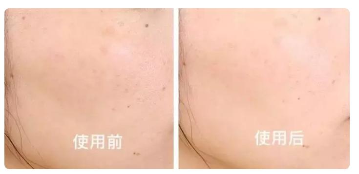 张韶涵沉浸式护肤的护肤品名称,张韶涵护肤用的产品