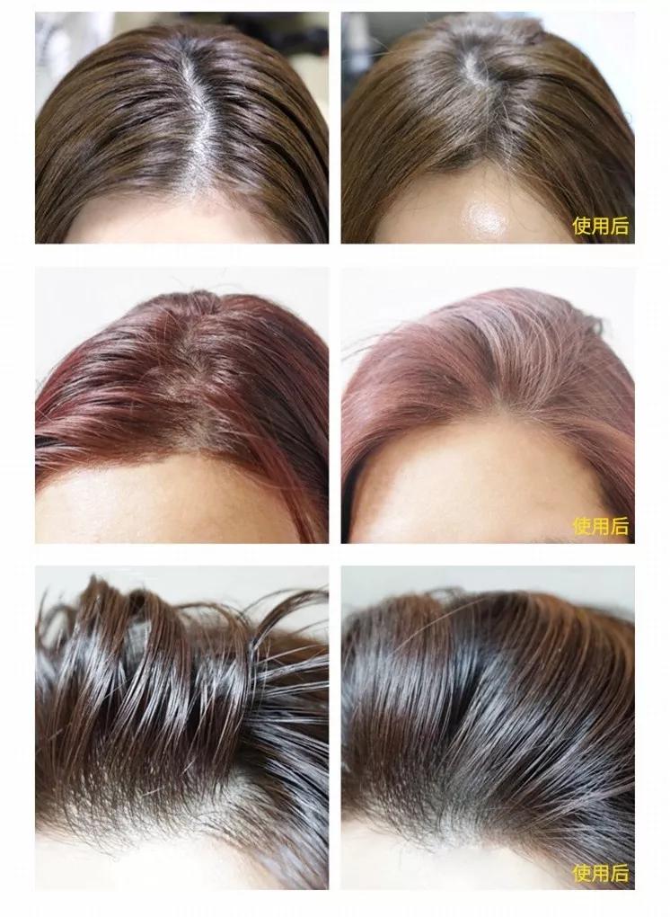 头发爱出油用什么可以变蓬松,头发油怎么才能头发蓬松干爽