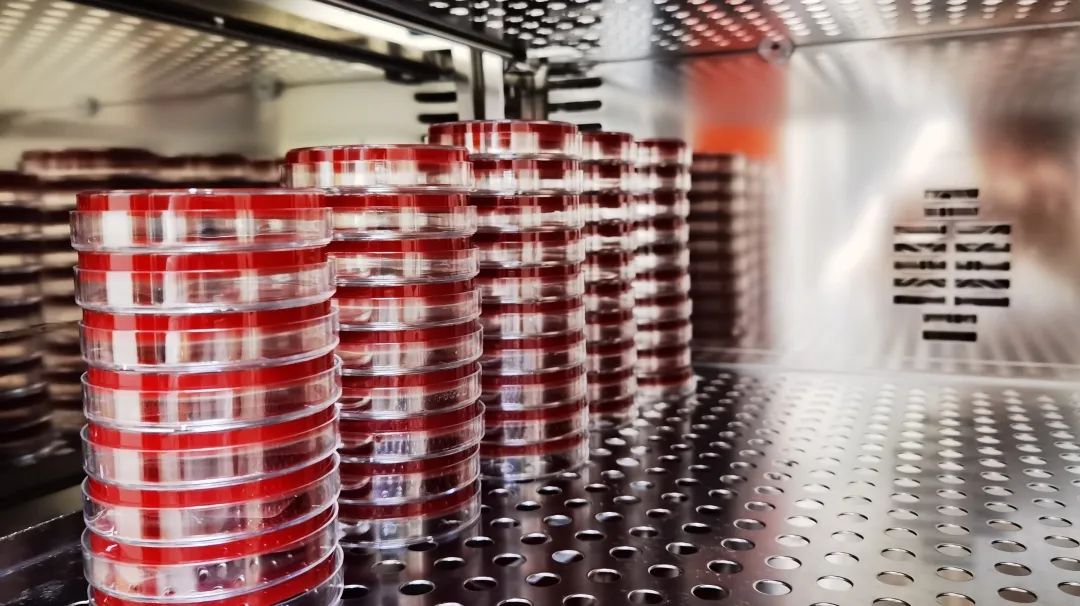 下腹痛白带水样,小腹疼白带多做什么检查