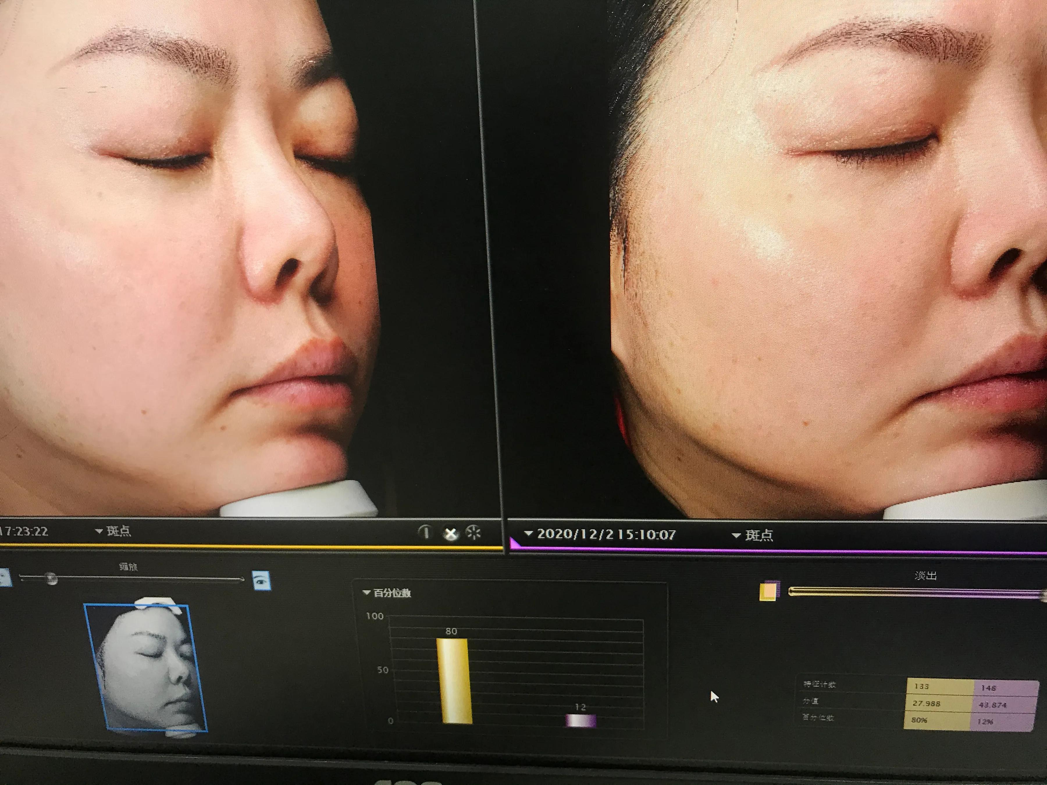 玉兰油大红瓶和sk2哪个好用,玉兰油大红瓶和sk2大红瓶比较