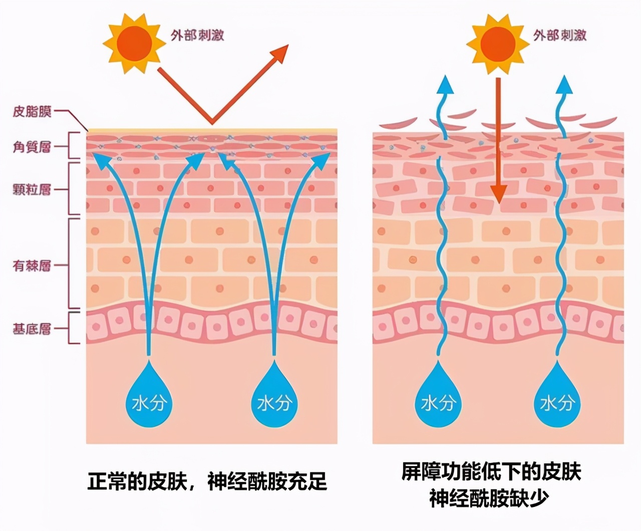 目前治疗红血丝最有效的方法,怎么样治疗红血丝的方法最有效