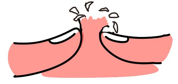 如何祛除痘印最有效的几招,教你几种有效去除痘印的方法