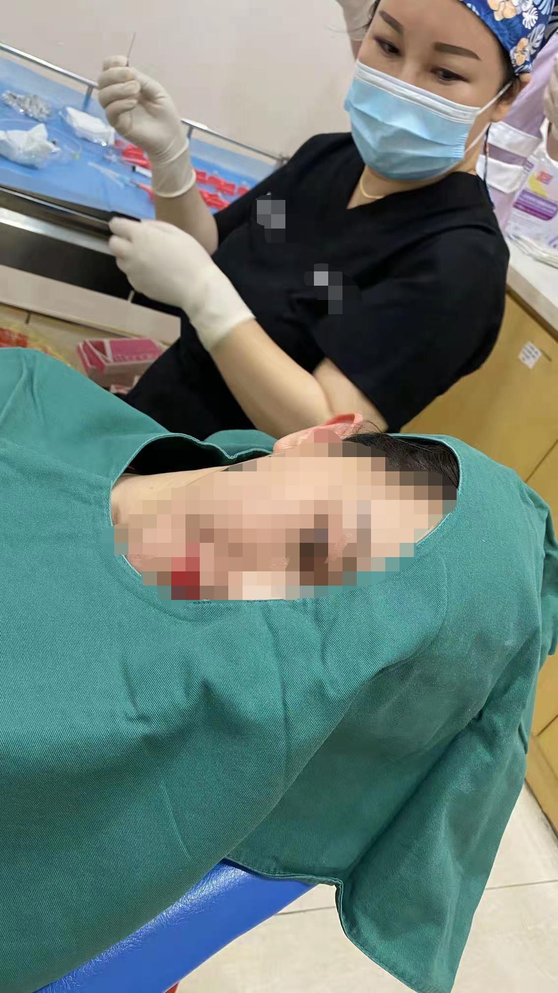 抽脂可能带来的后果,抽脂不当会损伤神经吗