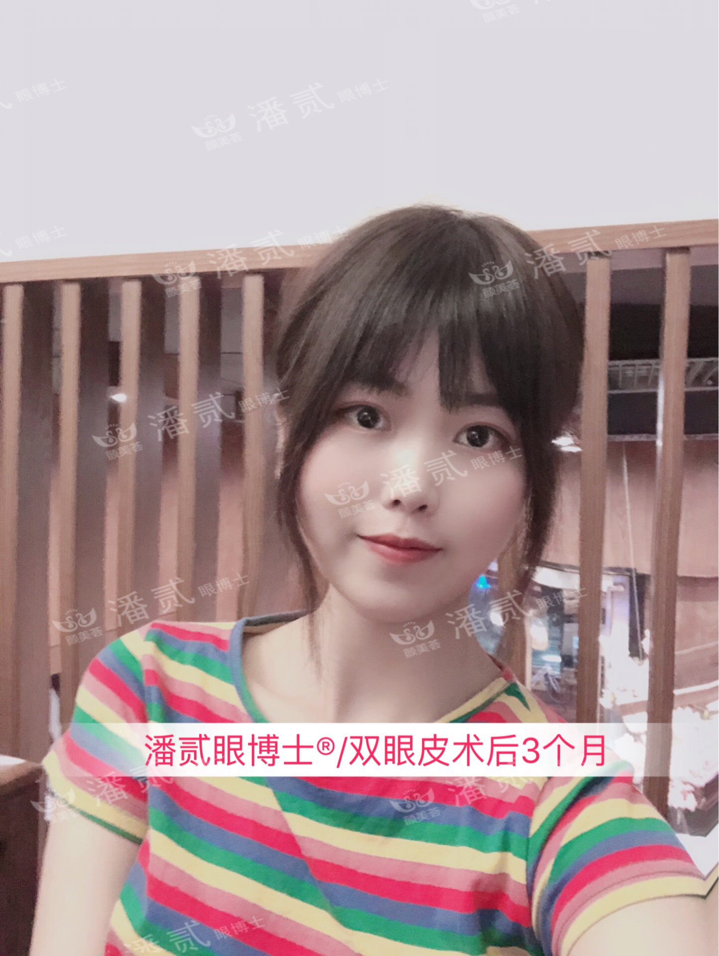 双眼皮眼尾割长了而且上扬怎么办,眼睛眼尾下垂做什么样双眼皮