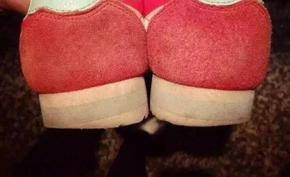 磨鞋底外侧是什么原因,穿鞋老是磨鞋底后外侧的解决办法