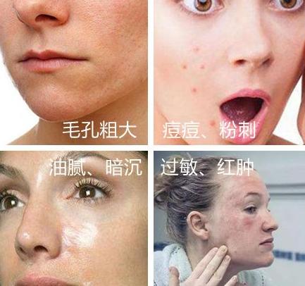 自吸黑头机,全自动吸黑头机