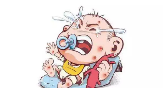 水痘一般在冬春季节更容易感染么,水痘每年春天和秋天都复发怎么办