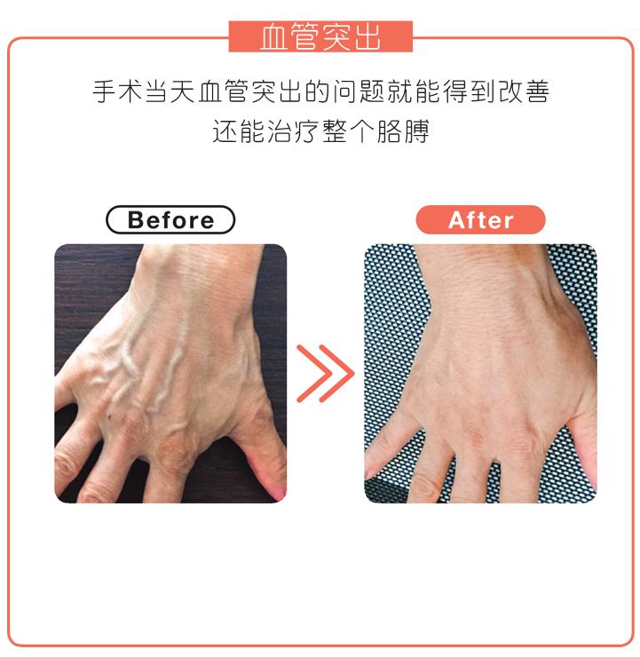 刘宇敷手膜,刘宇敷面膜视频