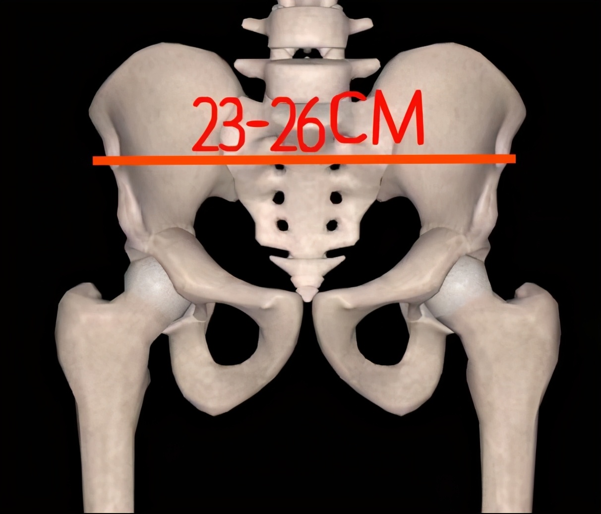 生宝宝选择剖腹产也需要做盆底肌修复，越早越好莫拖延
