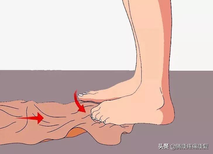 引起足部疼痛的原因,足底筋膜炎疼痛位置图
