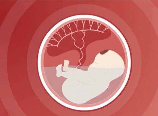 孕中后期出血怎么办？这三种原因，第一个易判断，后两个难预测