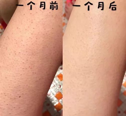 乳木果保暖润肤裤,乳木果磨砂膏去除角质