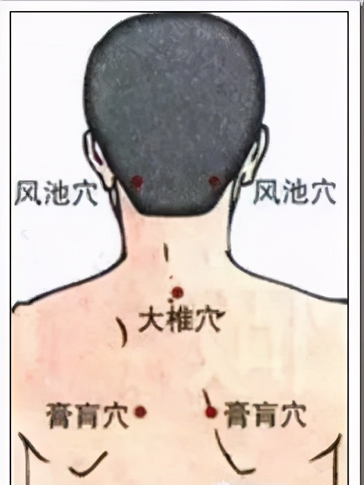 脖子后面的夺命包图片,脖子上有小包包是怎么回事