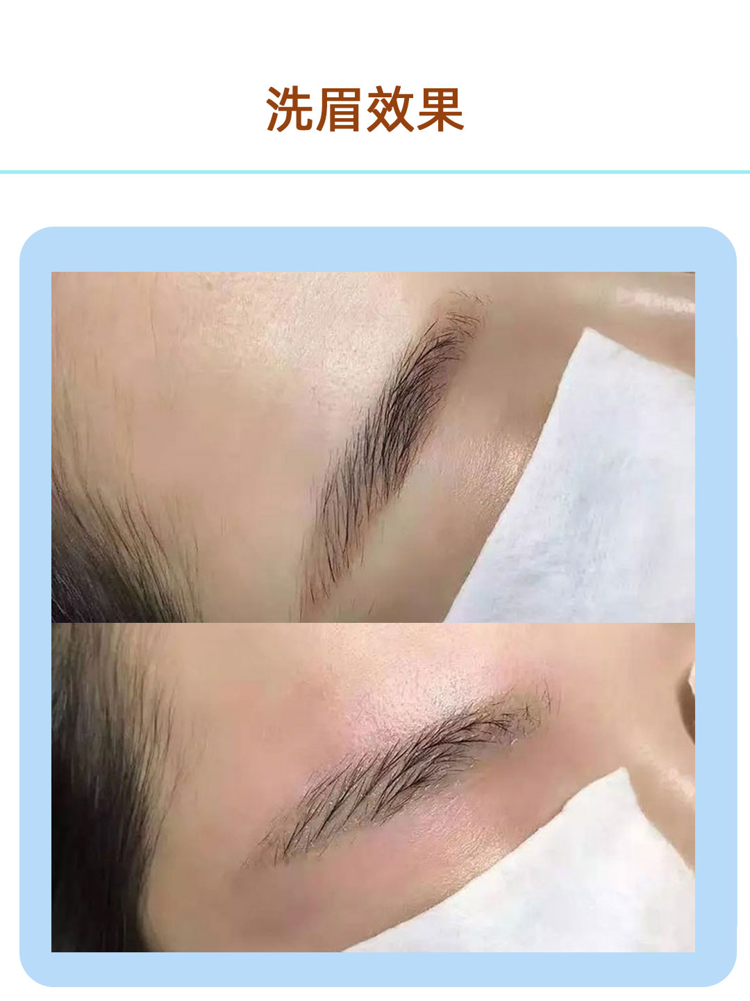 无创洗眉有市场吗,加盟无创洗眉