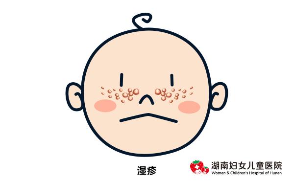 小孩夏天怎么防止痒疹,夏天的宝宝怎么避免热疹