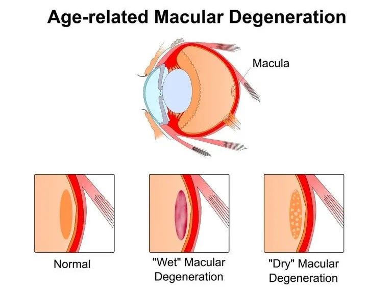 基因编辑技术治疗基因病,已经批准的基因编辑治疗技术
