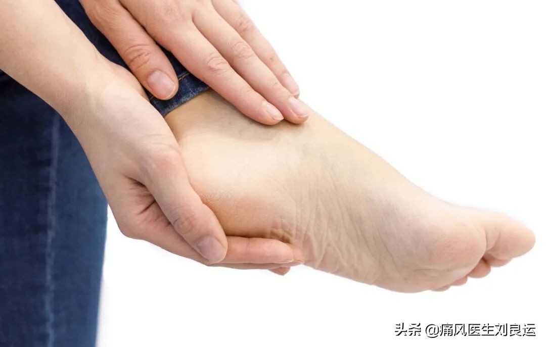 脚很痛不知道是扭伤还是痛风,脚痛不肿怎么判断是不是痛风
