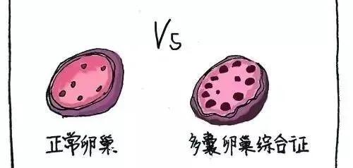 女生一年不来姨妈是怎么回事,女生一年不来大姨妈怎么回事