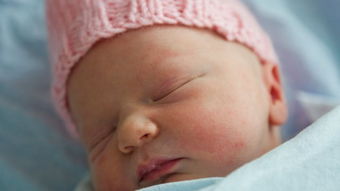 宝宝得了湿疹我该怎么办,宝宝湿疹不要焦虑