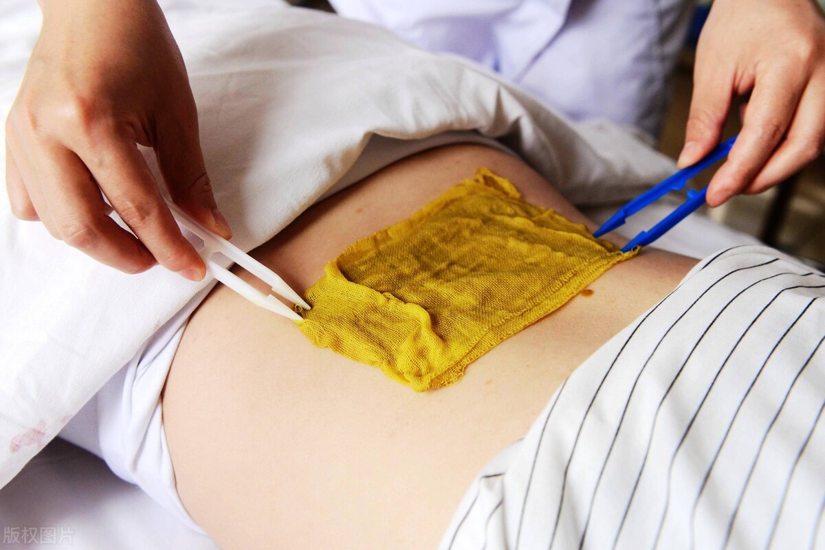 中医膏药贴敷注意事项,中药硬膏热贴敷治疗步骤