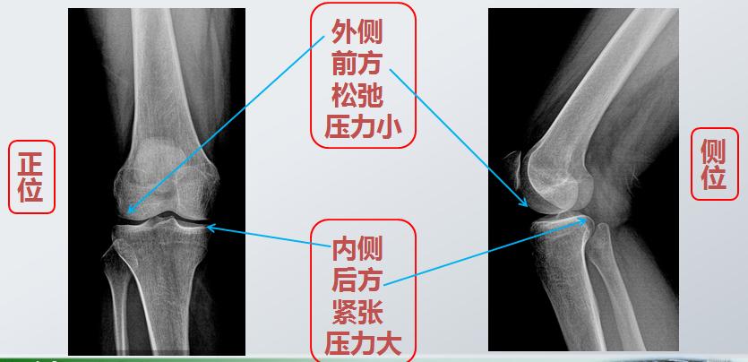 全身关节都有毛病怎么治,膝关节为什么会发炎