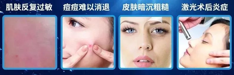 医用面膜和普通面膜有什么区别?医用面膜知识大科普!