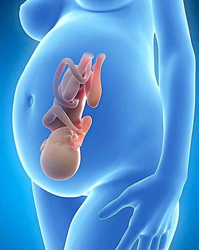 胎儿生长受限孩子出现智力低下,胎儿出生后智力低下