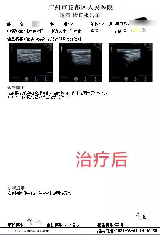 宝宝脖子歪向一边长大会自己好吗,小孩突然脖子歪一边痛什么原因