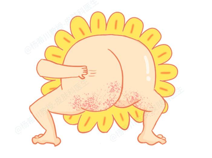 肛门瘙痒总想抠，怎么办？当心是这3类疾病