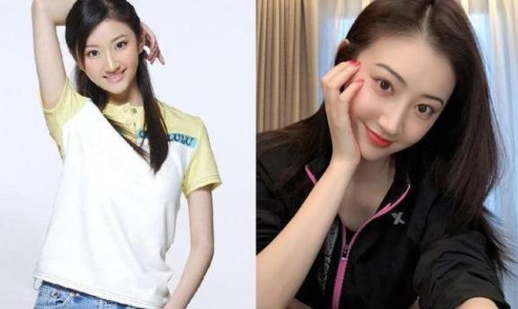 景甜自曝割双眼皮经历,景甜悲伤蛙双眼皮