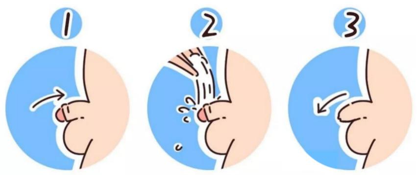 暑假来临，到底要不要带孩子去割包皮？