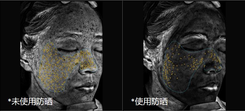 这款喷雾被李佳琦秒售空!防晒防蚊一步到位,一秒速干好清爽