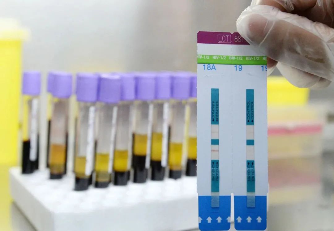 我们与艾滋病的距离视频,我们与艾滋距离