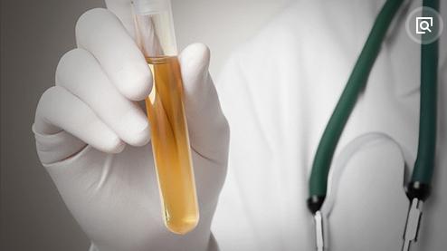 女性尿路感染总是反复怎么回事,女性反复尿路感染吃多久的消炎药