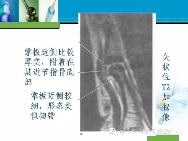 单只手指磁共振,手指用磁共振能做出来结果吗