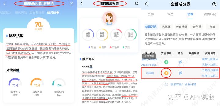 鼻子刷酸去黑头,毛孔粗大去黑头刷什么酸