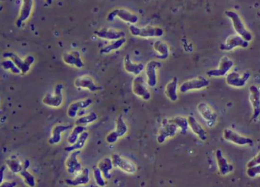 人应不应该勇敢追求爱情,人应不应该追求平凡