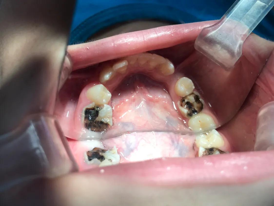 口腔垃圾怎么处理,口腔护理中的垃圾怎么分类处理