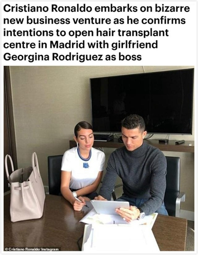 c罗是不是植发了,c罗有植发吗