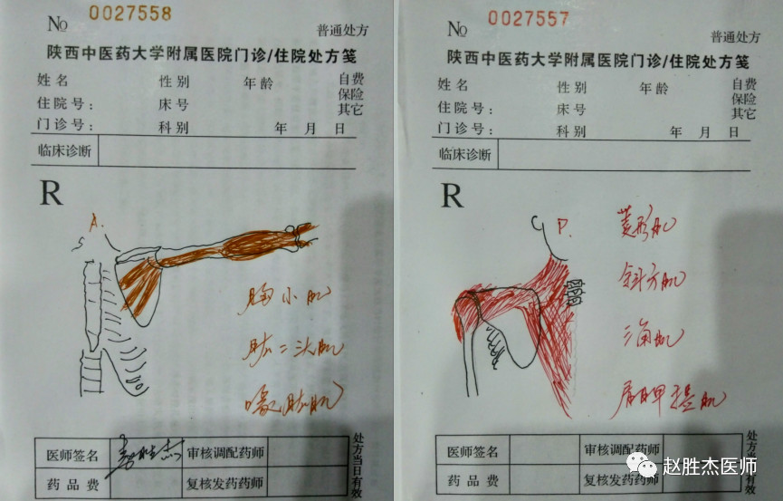 气功能治脊髓型颈椎病吗,气功导引法治疗颈椎病