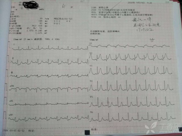 心电图心肌缺血冠脉造影正常,心脏彩超心电图冠脉造影正常