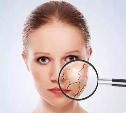 夏季常见皮肤病大片红肿,治不好的妇科病皮肤病有哪些