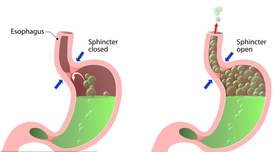 胆囊炎有哪些征兆,胆囊炎有4个征兆