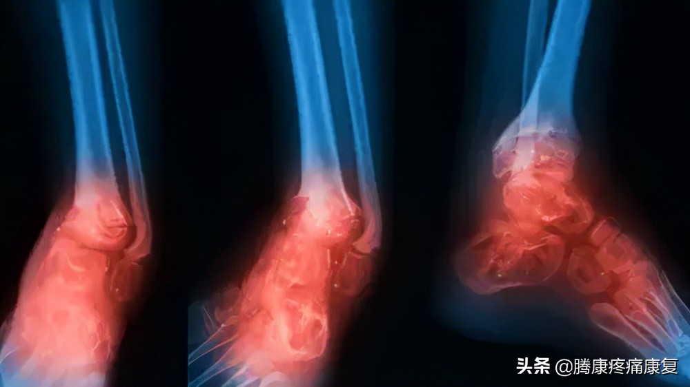 老人小腿疼痛是什么原因,脚小腿肌肉疼痛是什么原因