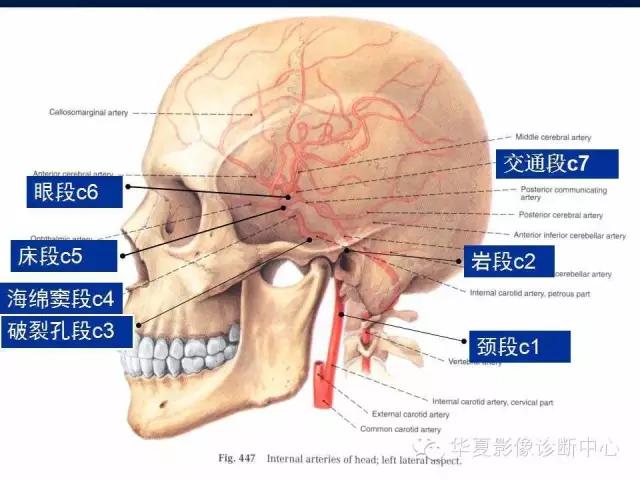 小脑血管解剖分段,脑血管影像解剖讲解